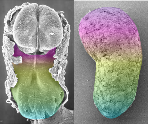 human embryo and human gastruloid