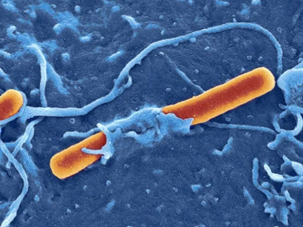 Shigella bacteria