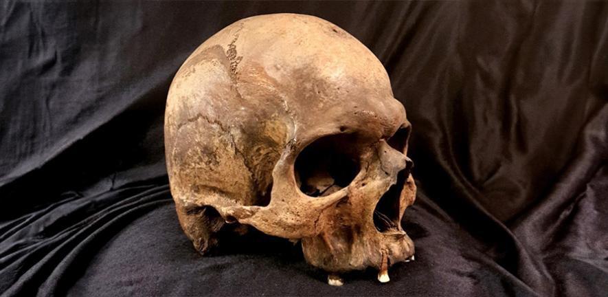 skull from Madesø, Denmark related to the study. Picture credit: Marie Louise Jørkov.